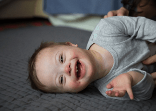 Embracing Down Syndrome Globally